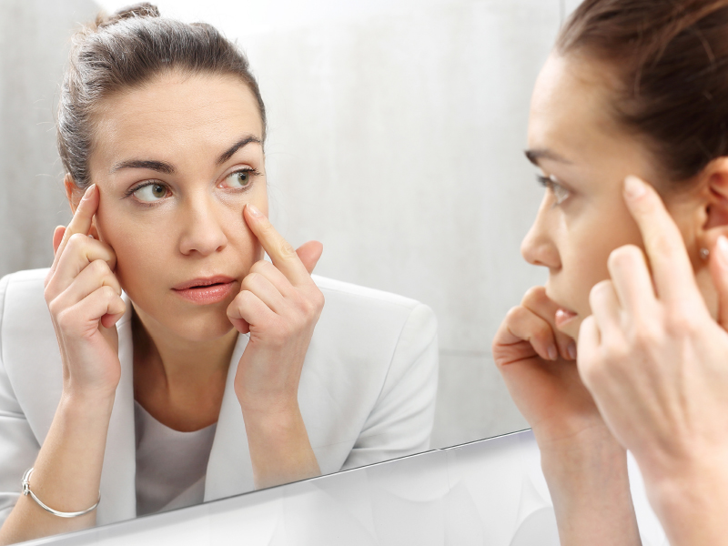 cirugia ojos blefaroplastia