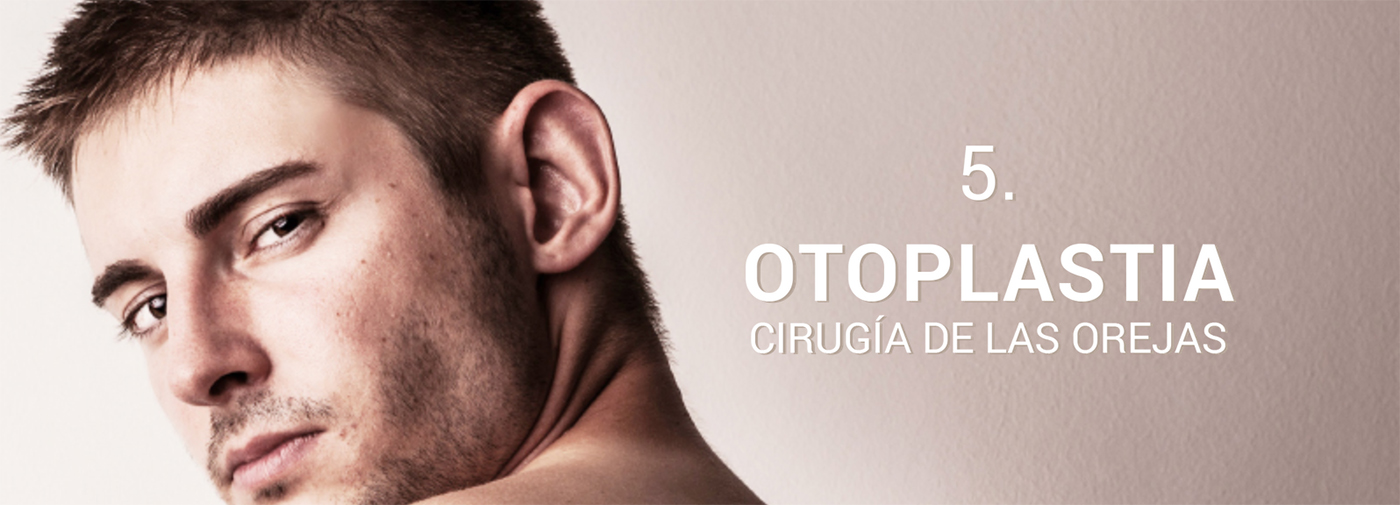 cirugia otoplastia