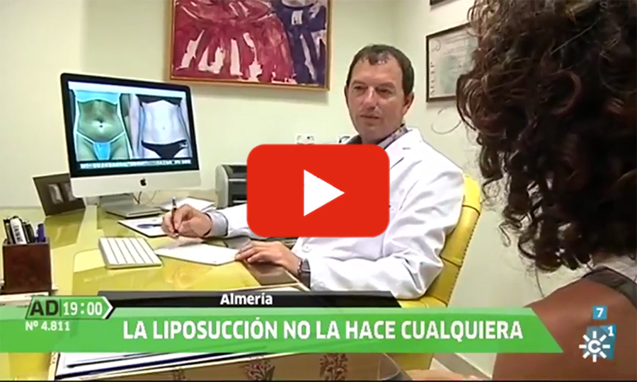 liposucción