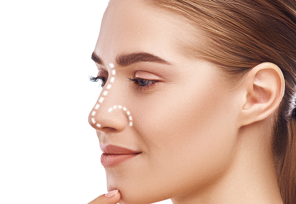 RINOPLASTIA FUNCIONAL